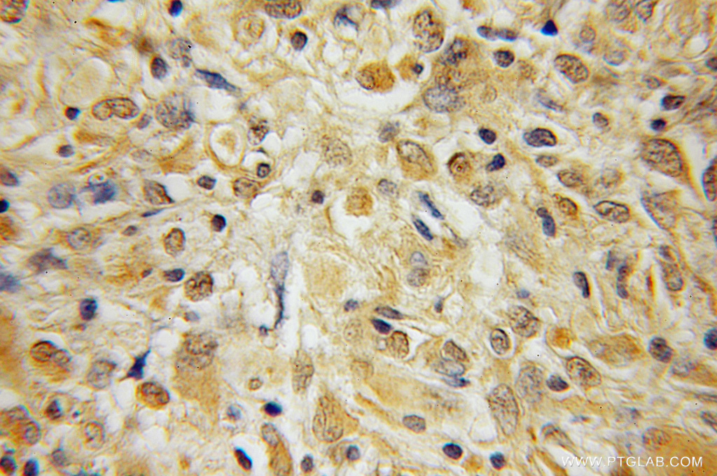 BEX1/2 Polyclonal antibody