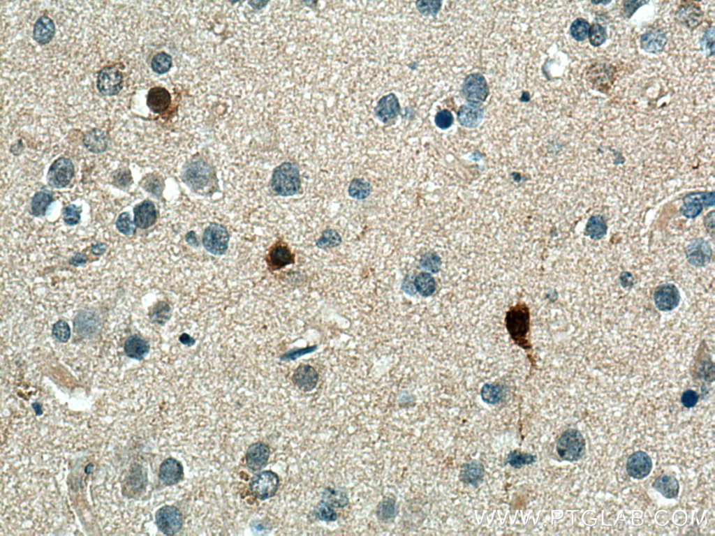 CA8 Polyclonal antibody