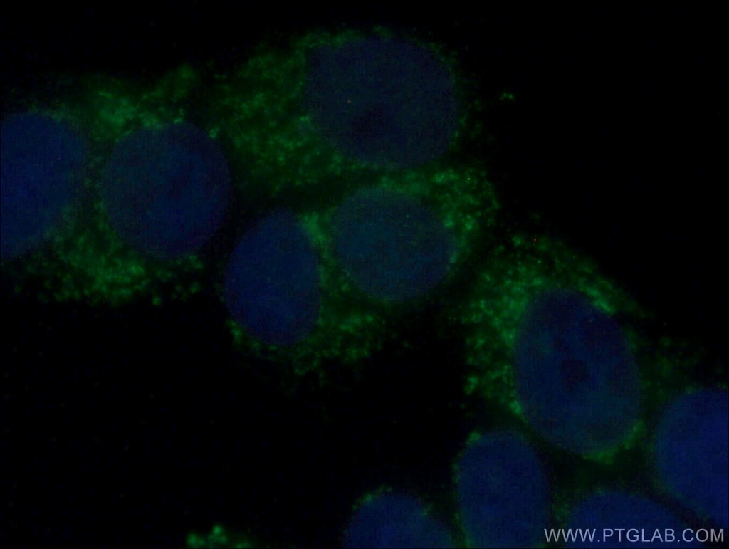A4GALT Polyclonal antibody