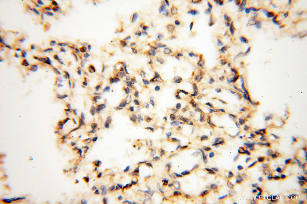 MAT1A Polyclonal antibody