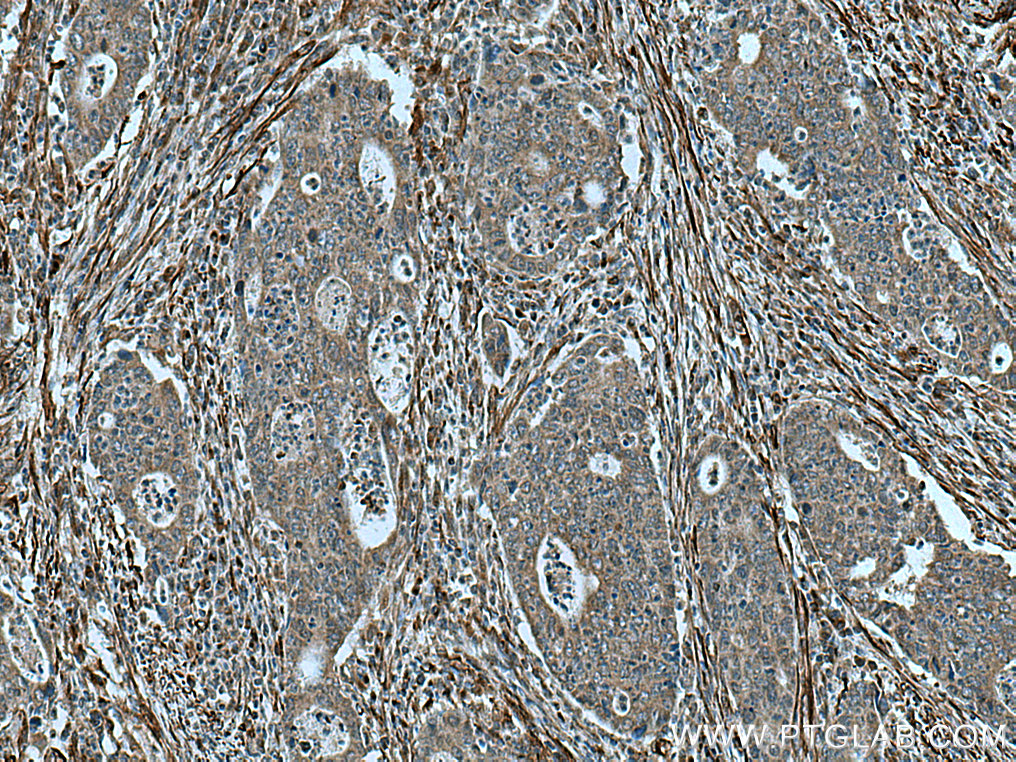 TPST1 Polyclonal antibody