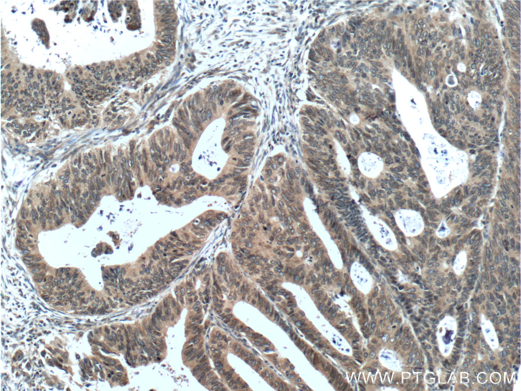 NUP133 Polyclonal antibody