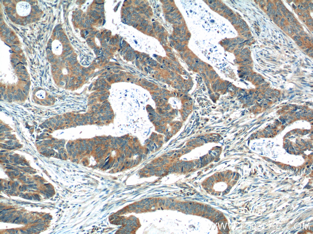 OSBPL3 Polyclonal antibody