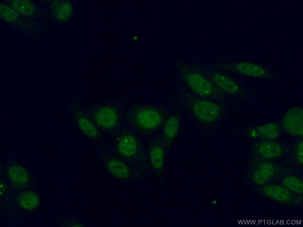RNGTT Polyclonal antibody