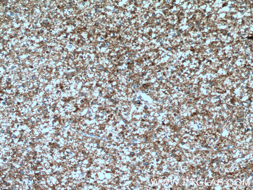 SH3GL2 Polyclonal antibody