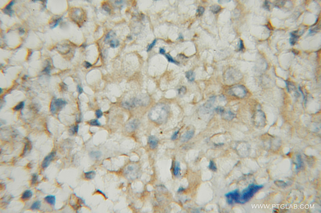 PDE1A Polyclonal antibody