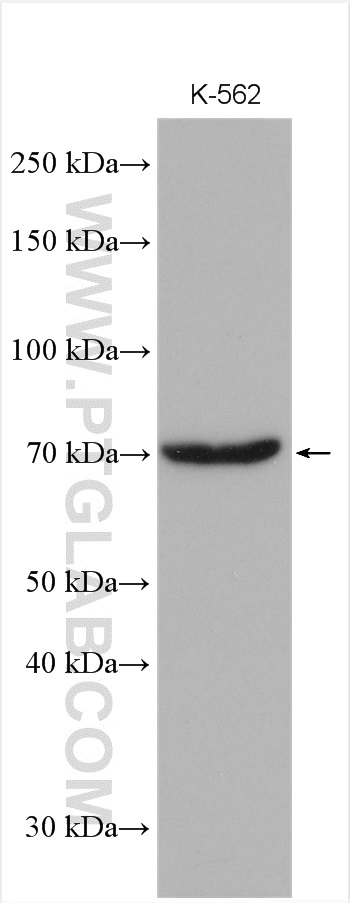 RPA1 Polyclonal antibody