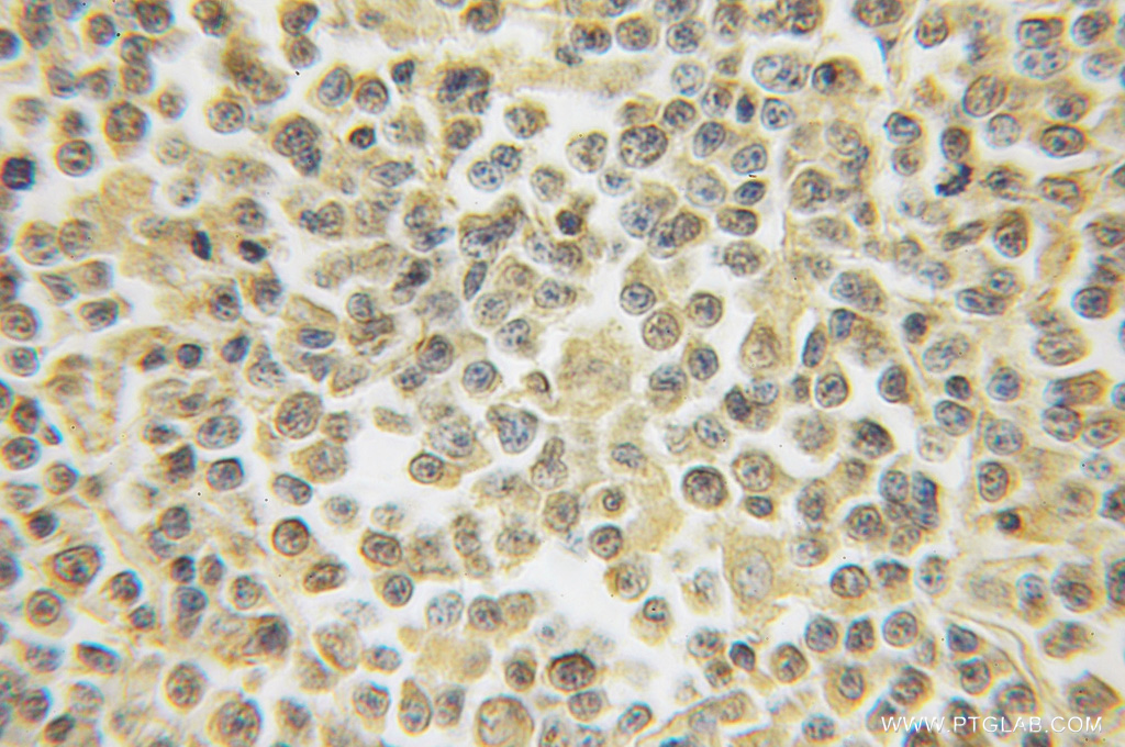 HS2ST1 Polyclonal antibody