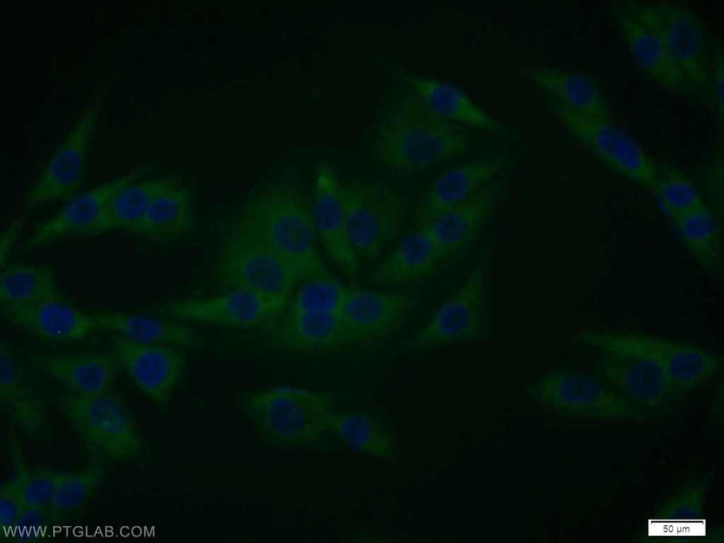 EPS8 Polyclonal antibody