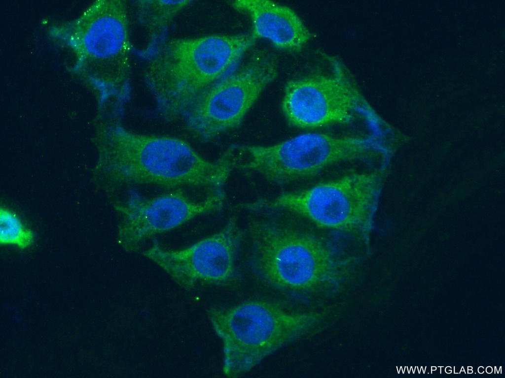 PIP4K2A Polyclonal antibody