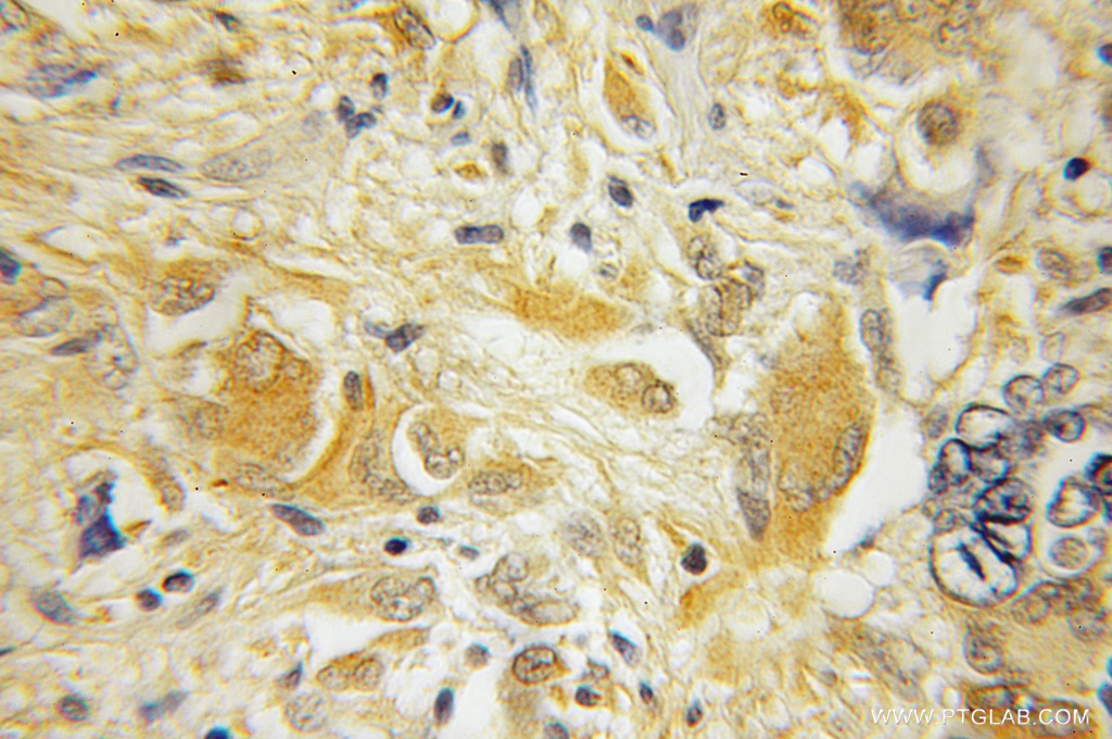 HPCAL4 Polyclonal antibody