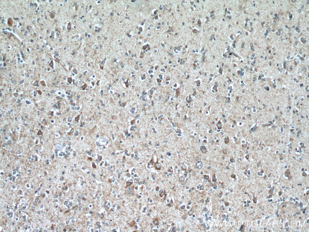 MOBP Polyclonal antibody