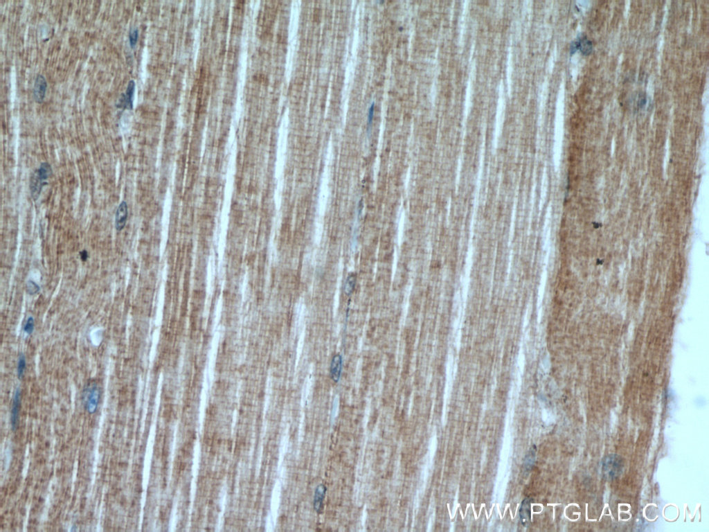 Ephrin A3 Polyclonal antibody