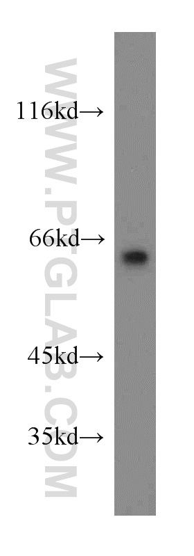 LGI1 Polyclonal antibody