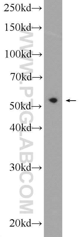 PDCD7 Polyclonal antibody