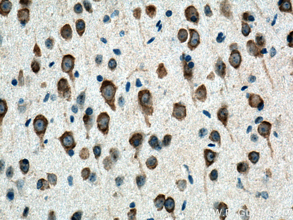CYP46A1 Polyclonal antibody