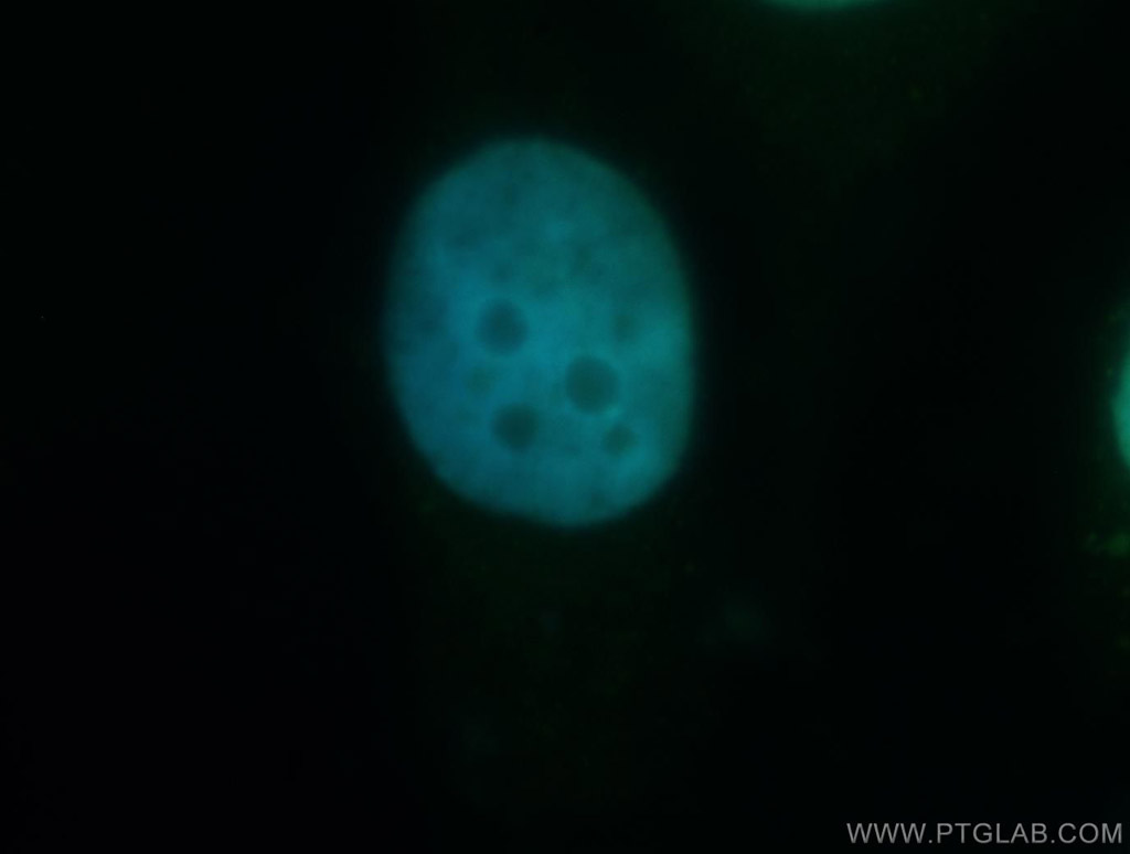 CRTC2,TORC2 Polyclonal antibody