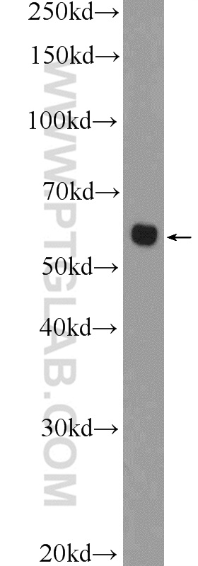 CHST1 Polyclonal antibody