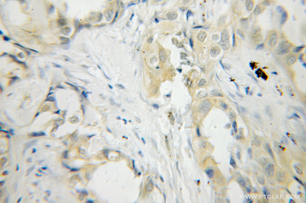 PLEK Polyclonal antibody