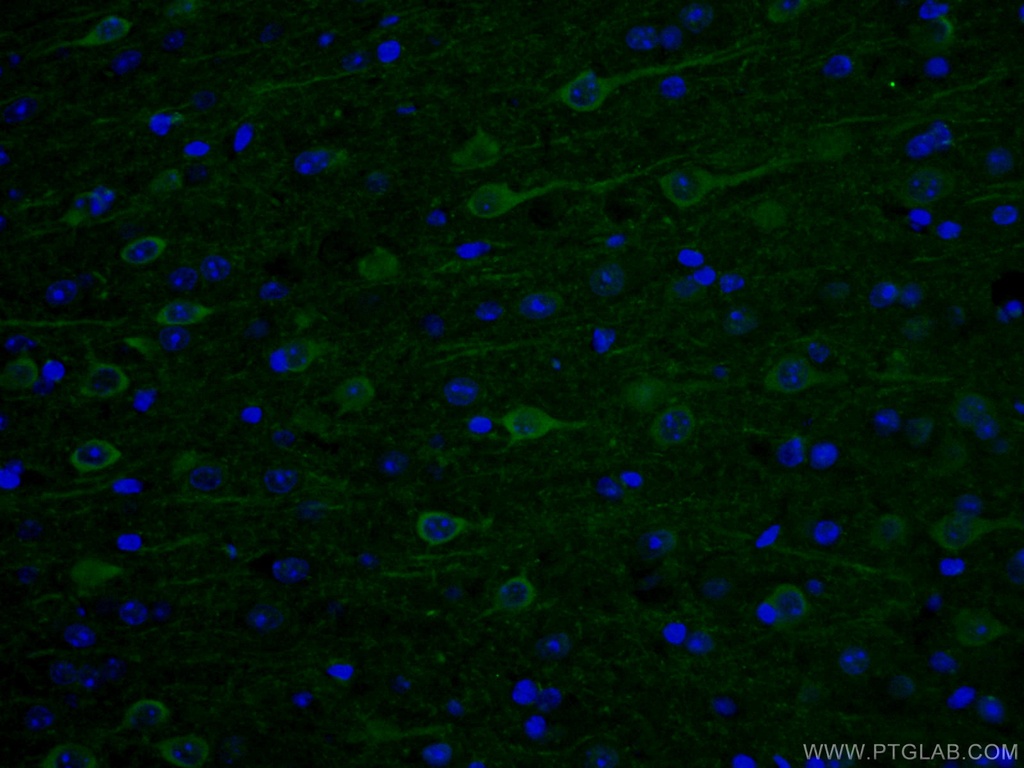 AK5 Polyclonal antibody