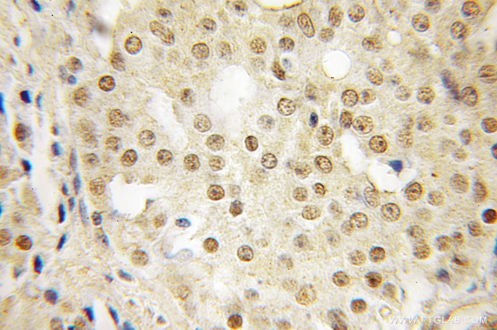 SFRS14 Polyclonal antibody