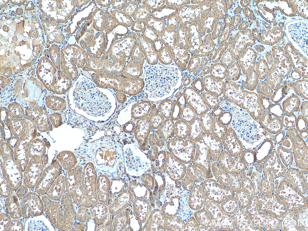 TMOD3 Polyclonal antibody