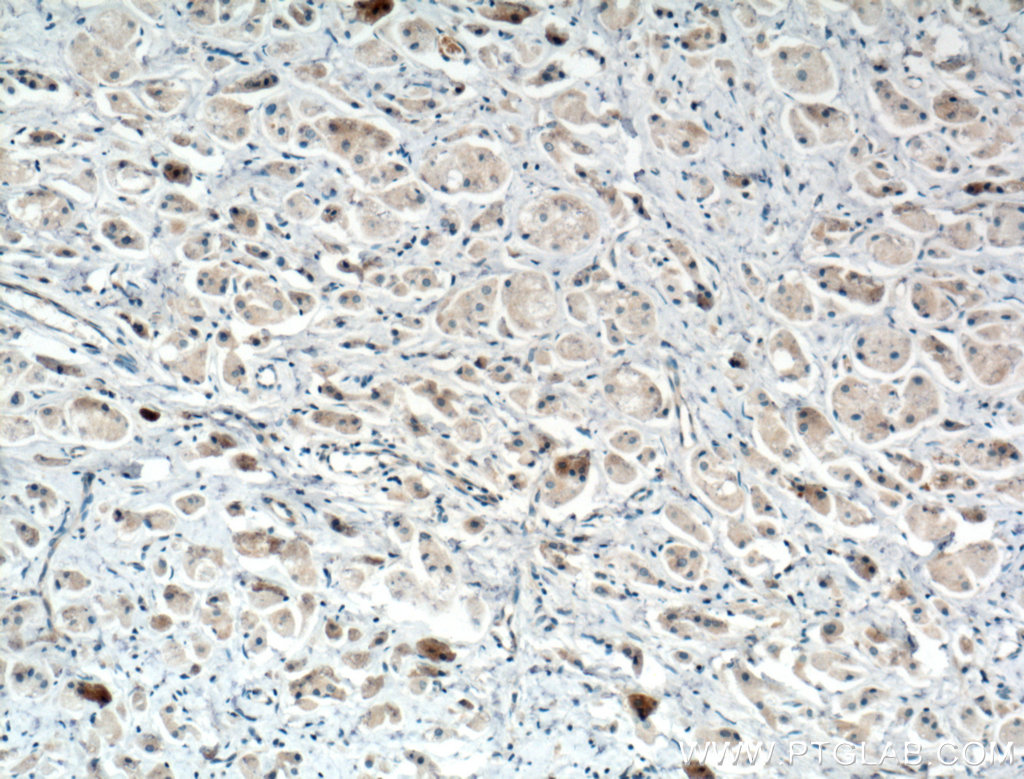 SULT1E1 Polyclonal antibody