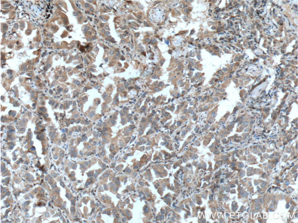 PLAA Polyclonal antibody