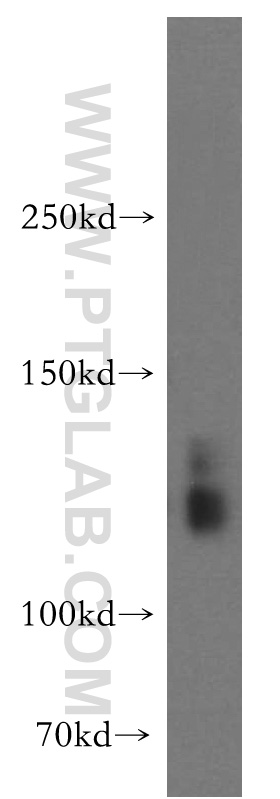 SLC4A8 Polyclonal antibody