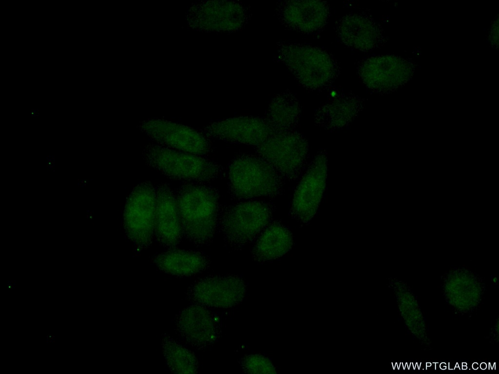 HNF1B Polyclonal antibody