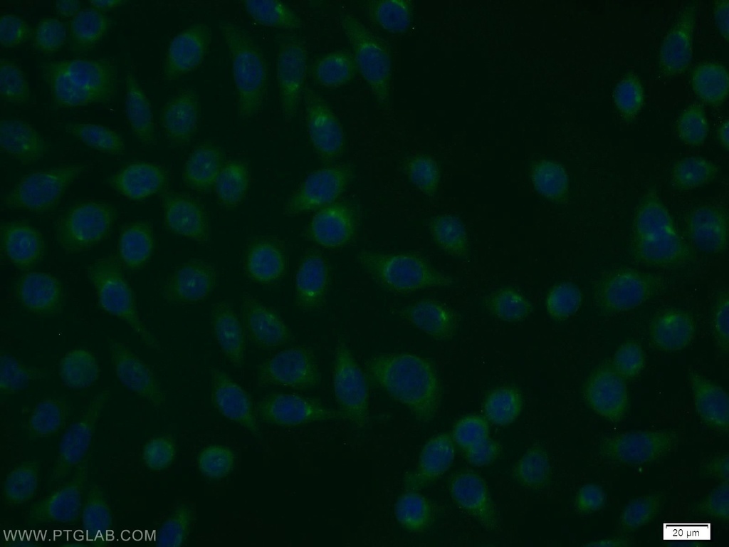 RGS17 Polyclonal antibody