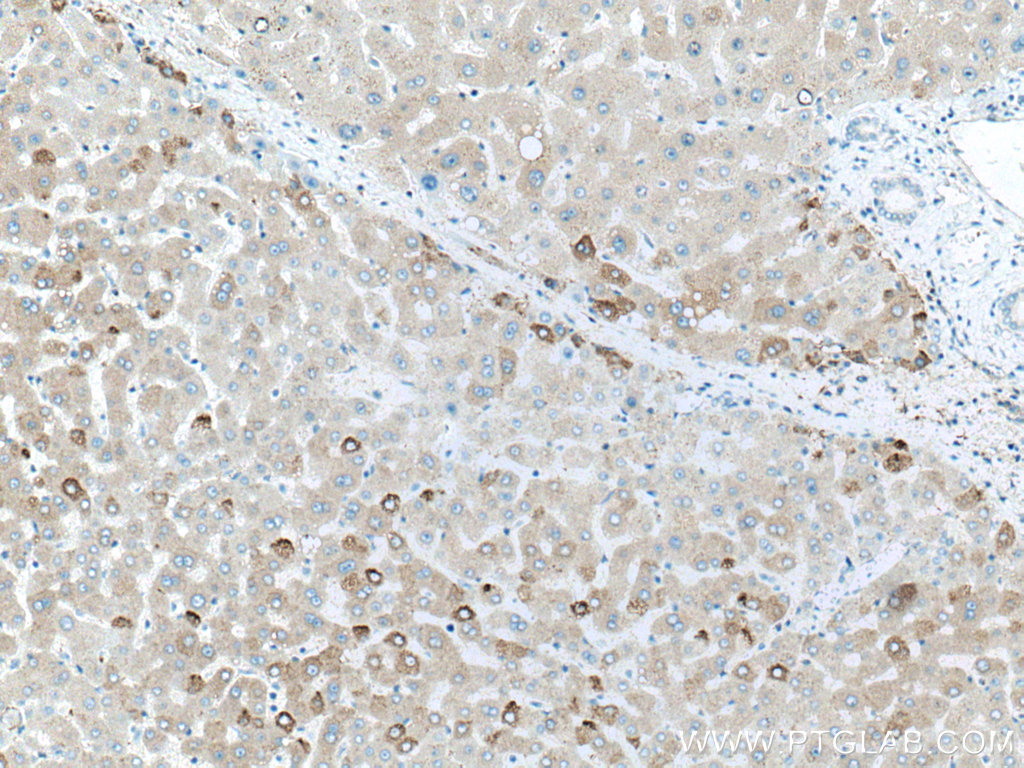 Factor XII Polyclonal antibody