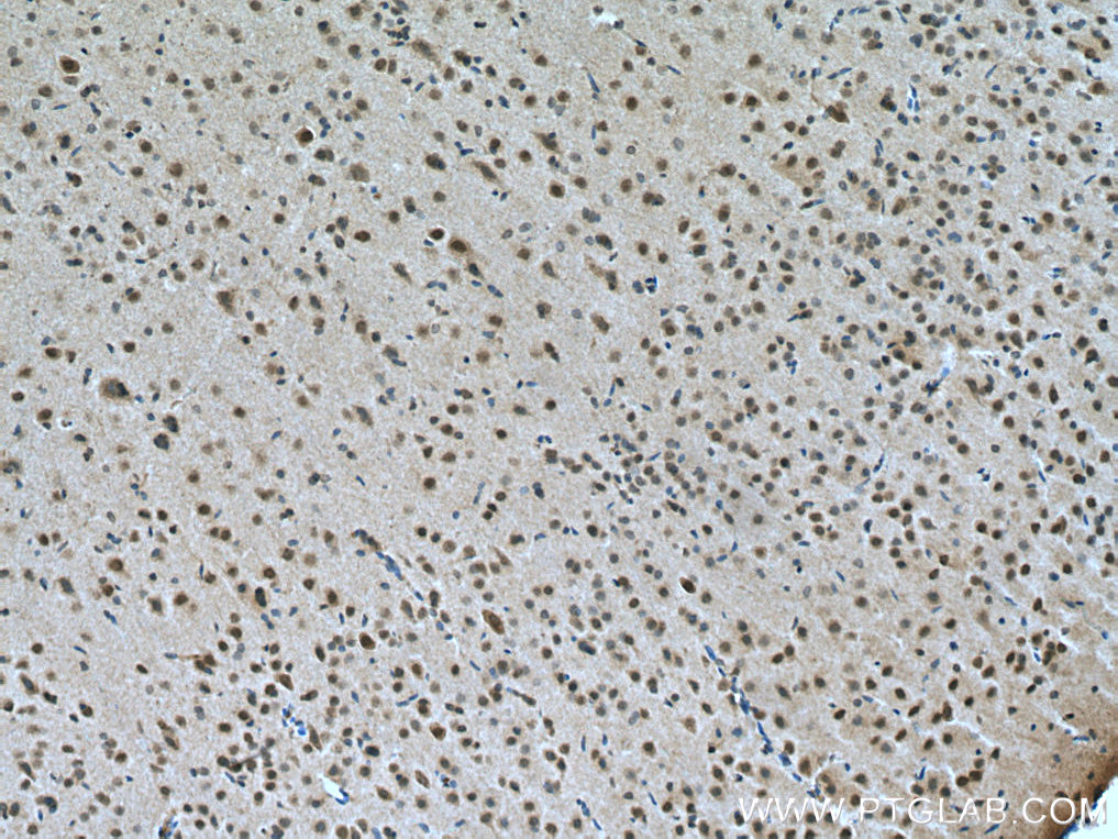 PRMT8 Polyclonal antibody