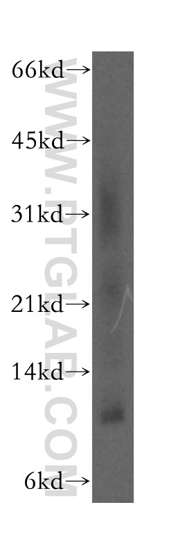 SELK Polyclonal antibody
