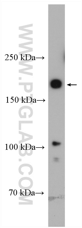 PBRM1 Polyclonal antibody
