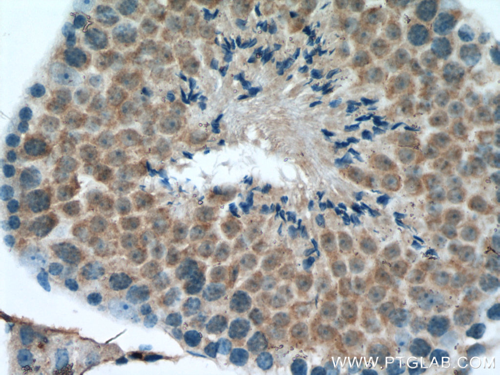 ROPN1L Polyclonal antibody