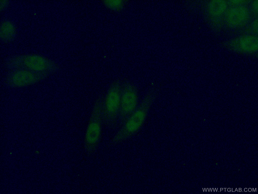 PBX3 Polyclonal antibody