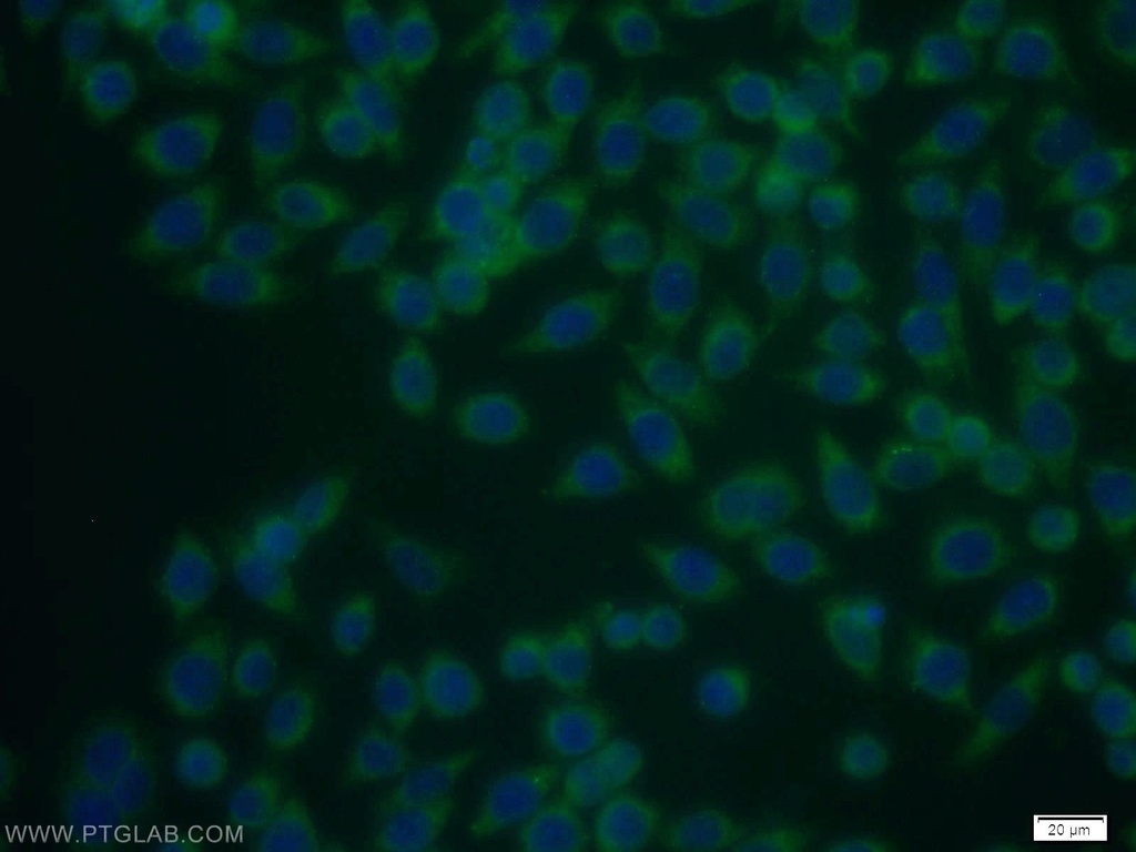 TSP50 Polyclonal antibody