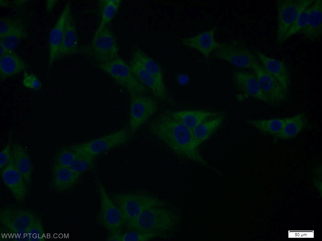 PTTG1IP Polyclonal antibody
