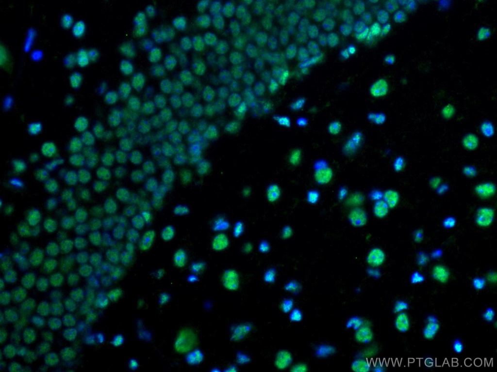 PTBP1 Polyclonal antibody