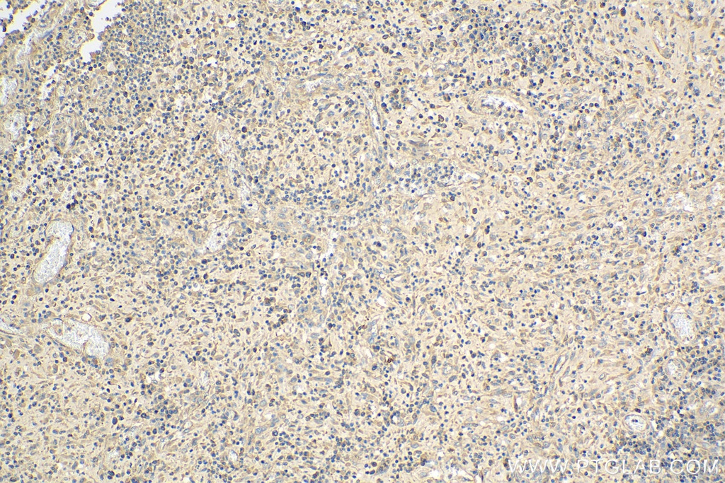 ARHGAP29 Polyclonal antibody