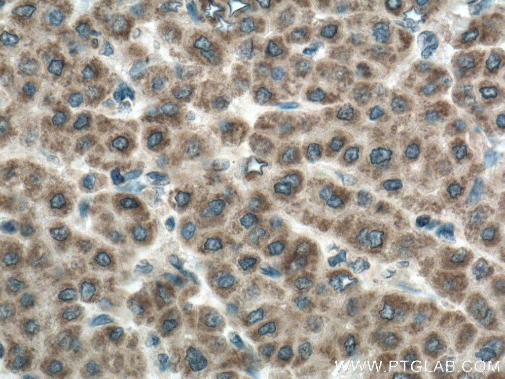 CDO1 Polyclonal antibody