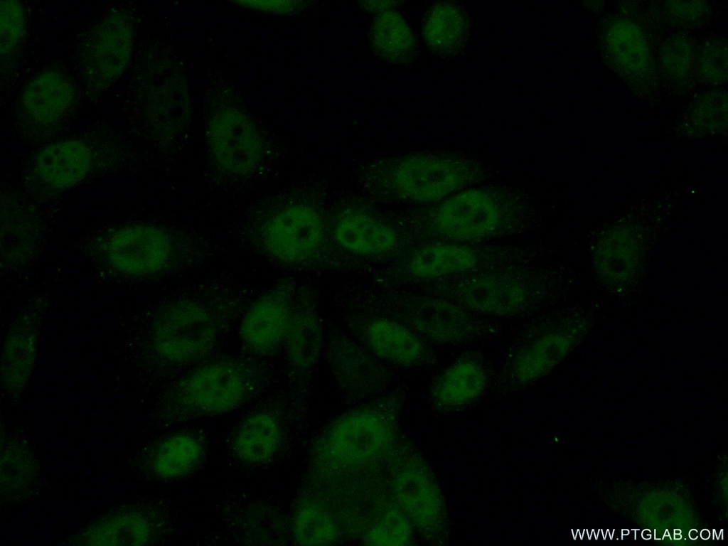 GABPB1 Polyclonal antibody