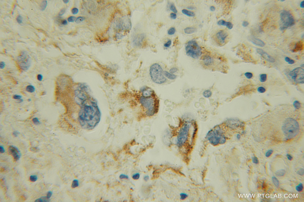 MAOB Polyclonal antibody