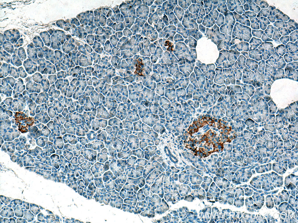 ACVR1C Polyclonal antibody
