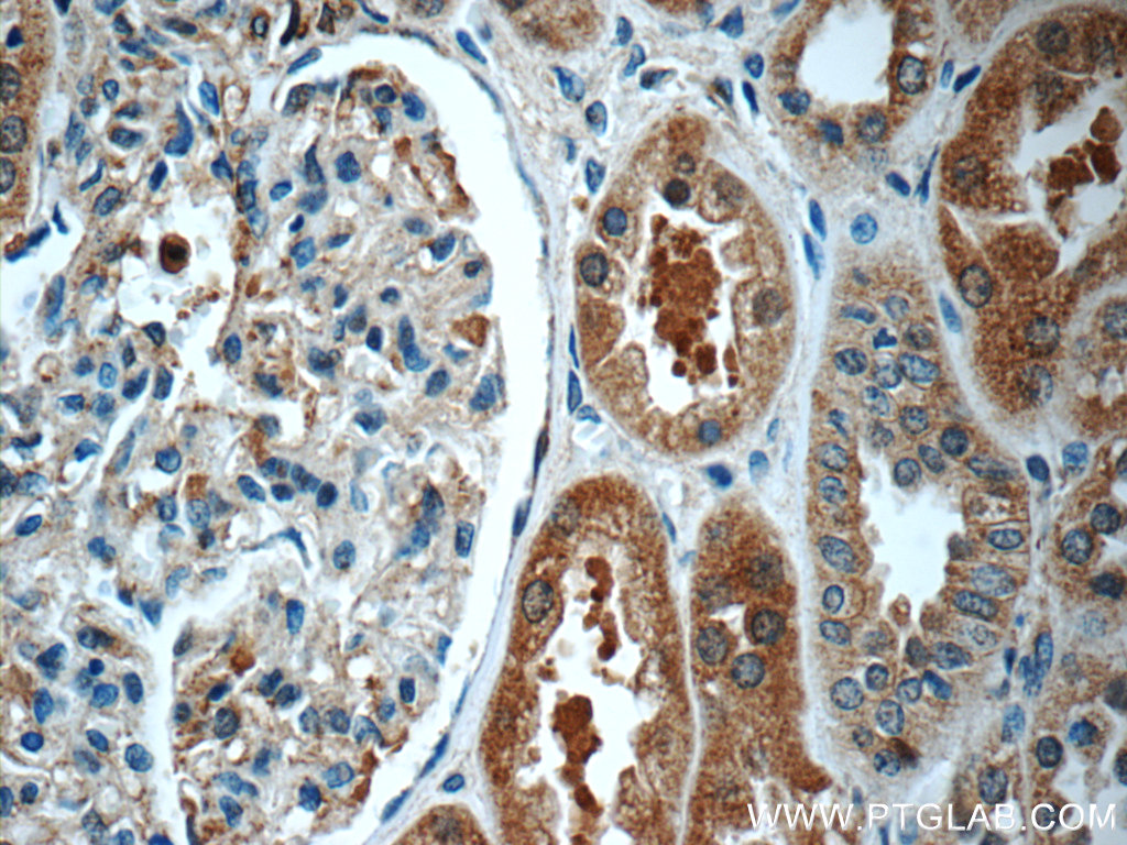 ECOP Polyclonal antibody