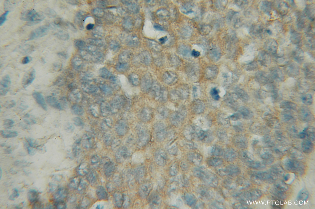 PIGB Polyclonal antibody