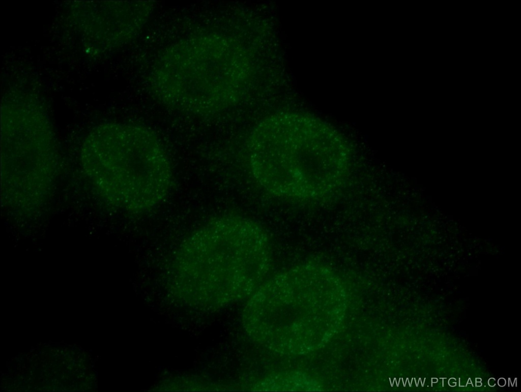 HOXB7 Polyclonal antibody