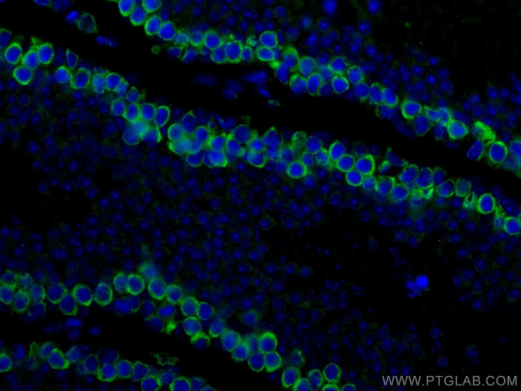DAZL Polyclonal antibody