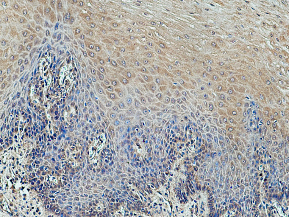 DIRAS1 Polyclonal antibody